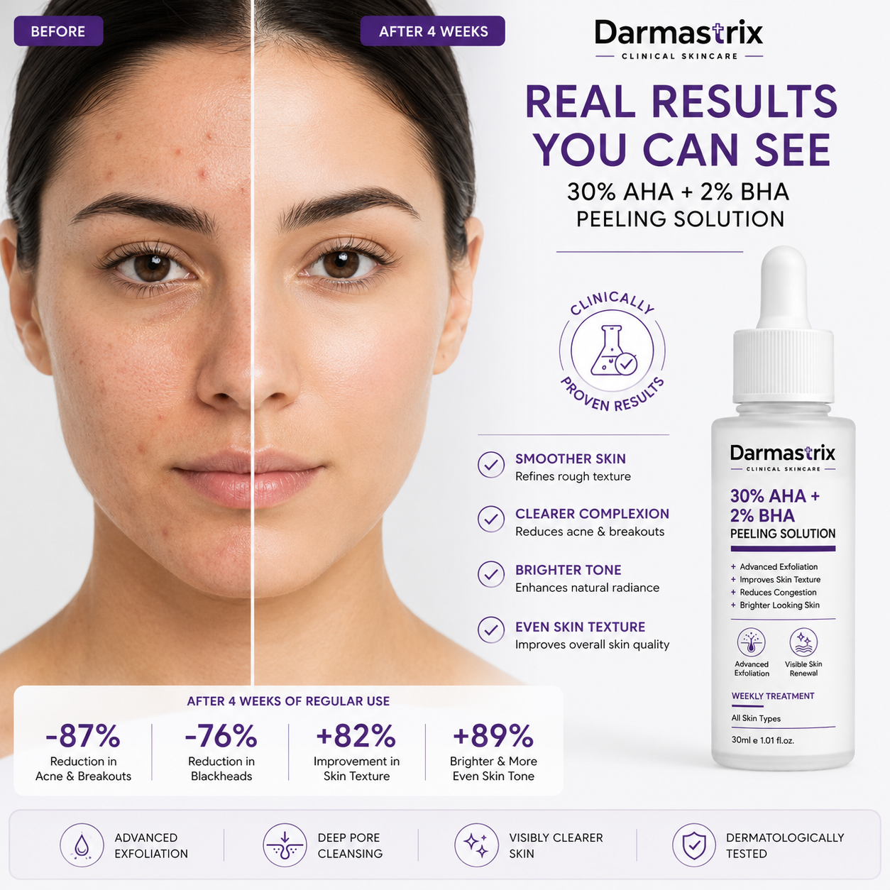 Darmastrix 30% AHA + 2% BHA Peeling Solution | Advanced Weekly Exfoliating Treatment | Improves Skin Texture, Reduces Congestion & Reveals Brighter Skin (30ml)