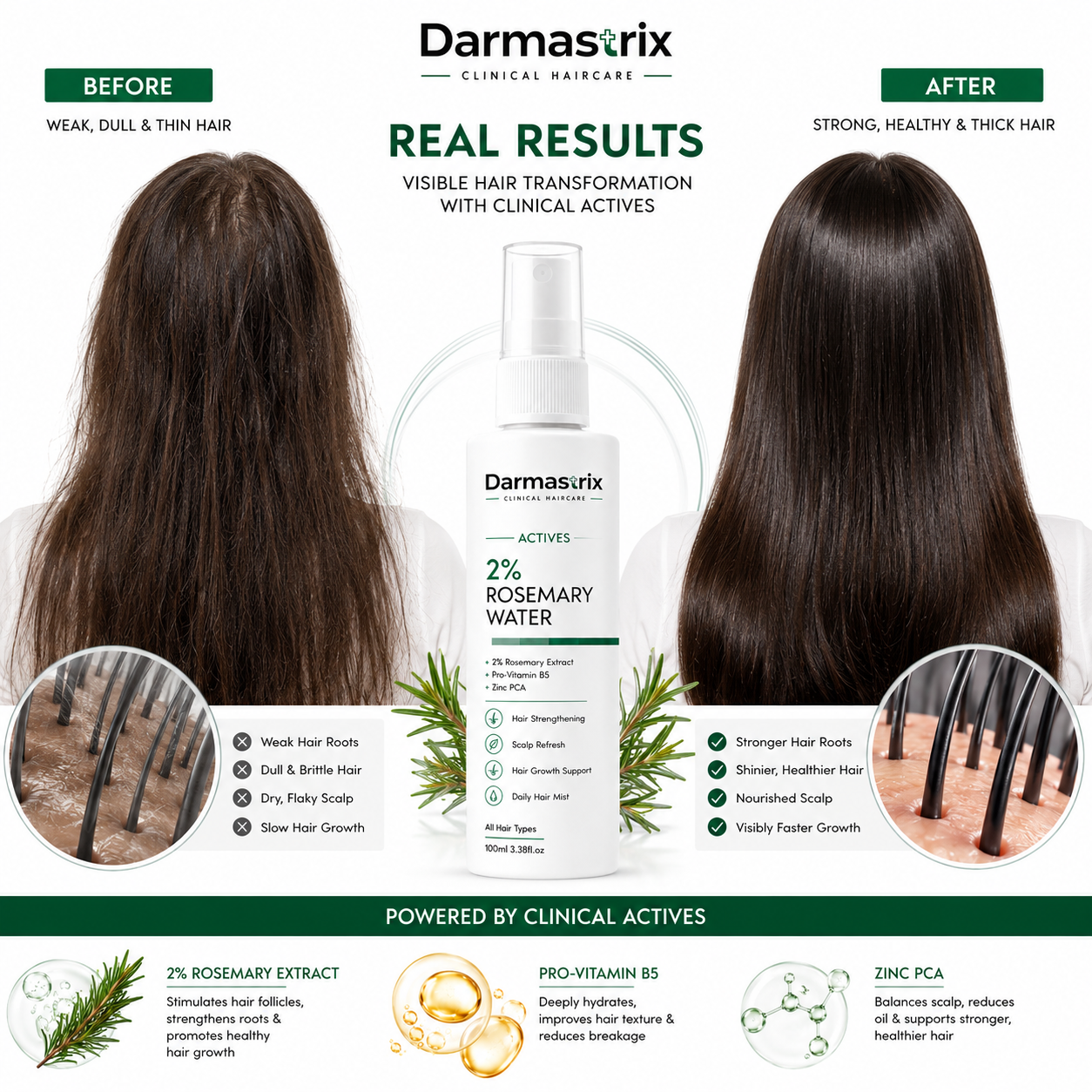Darmastrix 2% Rosemary Water Hair Mist | Hair Growth & Scalp Refresh Spray with Pro-Vitamin B5 & Zinc PCA | 100ml