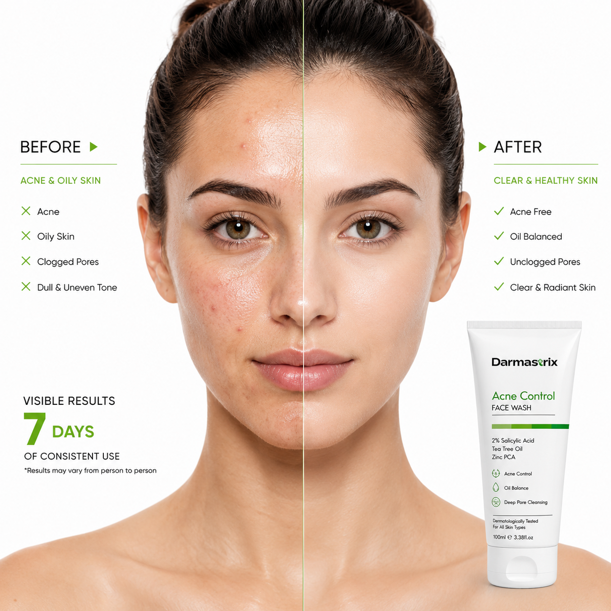 Darmastrix Acne Control Face Wash | 2% Salicylic Acid Face Cleanser with Tea Tree Oil & Zinc PCA | Deep Pore Cleansing & Oil Control Face Wash for Acne-Prone Skin (100ml)